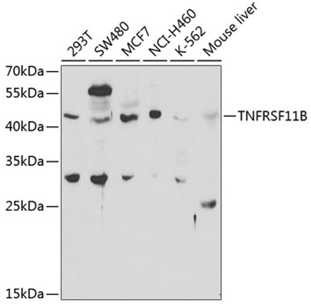 Western blot analysis of extracts of various cell lines, using TNFRSF11B antibody (18-500) at 1:1000 dilution.<br/>Secondary antibody: HRP Goat Anti-Rabbit IgG (H+L) at 1:10000 dilution.<br/>Lysates/proteins: 25ug per lane.<br/>Blocking buffer: 3% nonfat dry milk in TBST.