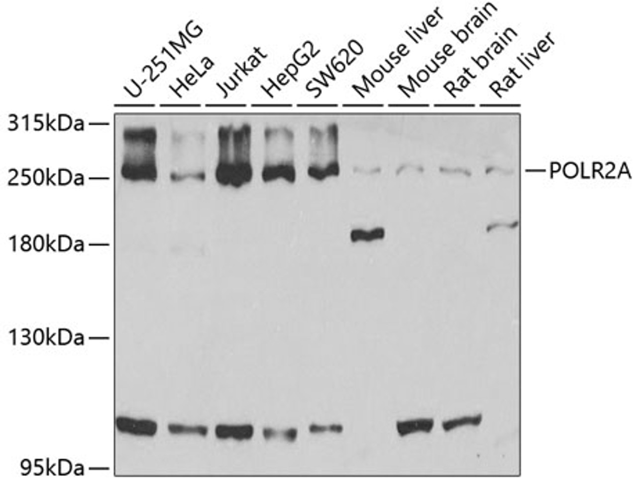 Western blot analysis of extracts of various cell lines, using POLR2A antibody (18-506) at 1:1000 dilution.<br/>Secondary antibody: HRP Goat Anti-Rabbit IgG (H+L) at 1:10000 dilution.<br/>Lysates/proteins: 25ug per lane.<br/>Blocking buffer: 3% nonfat dry milk in TBST.<br/>Detection: ECL Basic Kit.<br/>Exposure time: 90s.