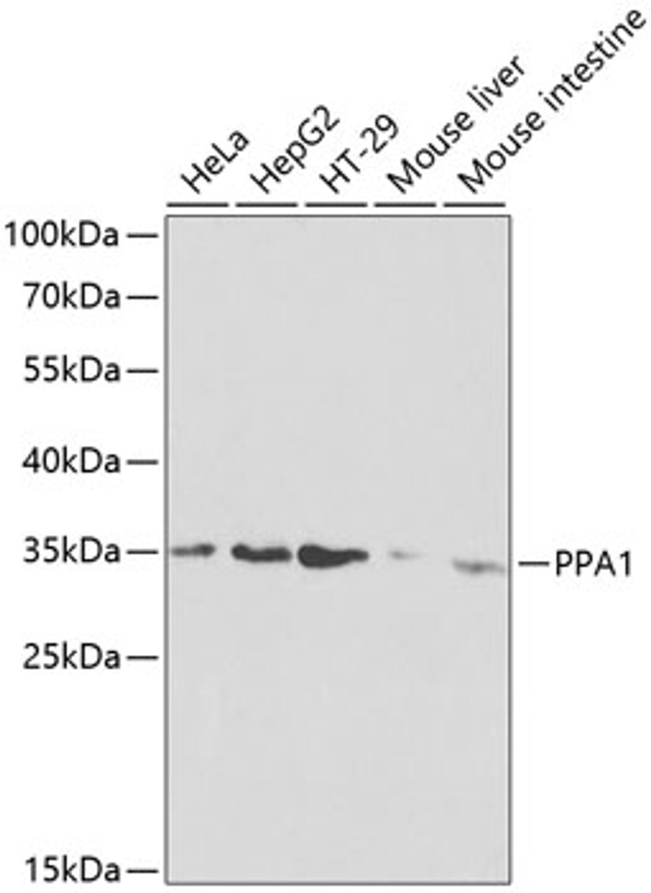 Western blot analysis of extracts of various cell lines, using PPA1 antibody (18-507) at 1:1000 dilution.<br/>Secondary antibody: HRP Goat Anti-Rabbit IgG (H+L) at 1:10000 dilution.<br/>Lysates/proteins: 25ug per lane.<br/>Blocking buffer: 3% nonfat dry milk in TBST.