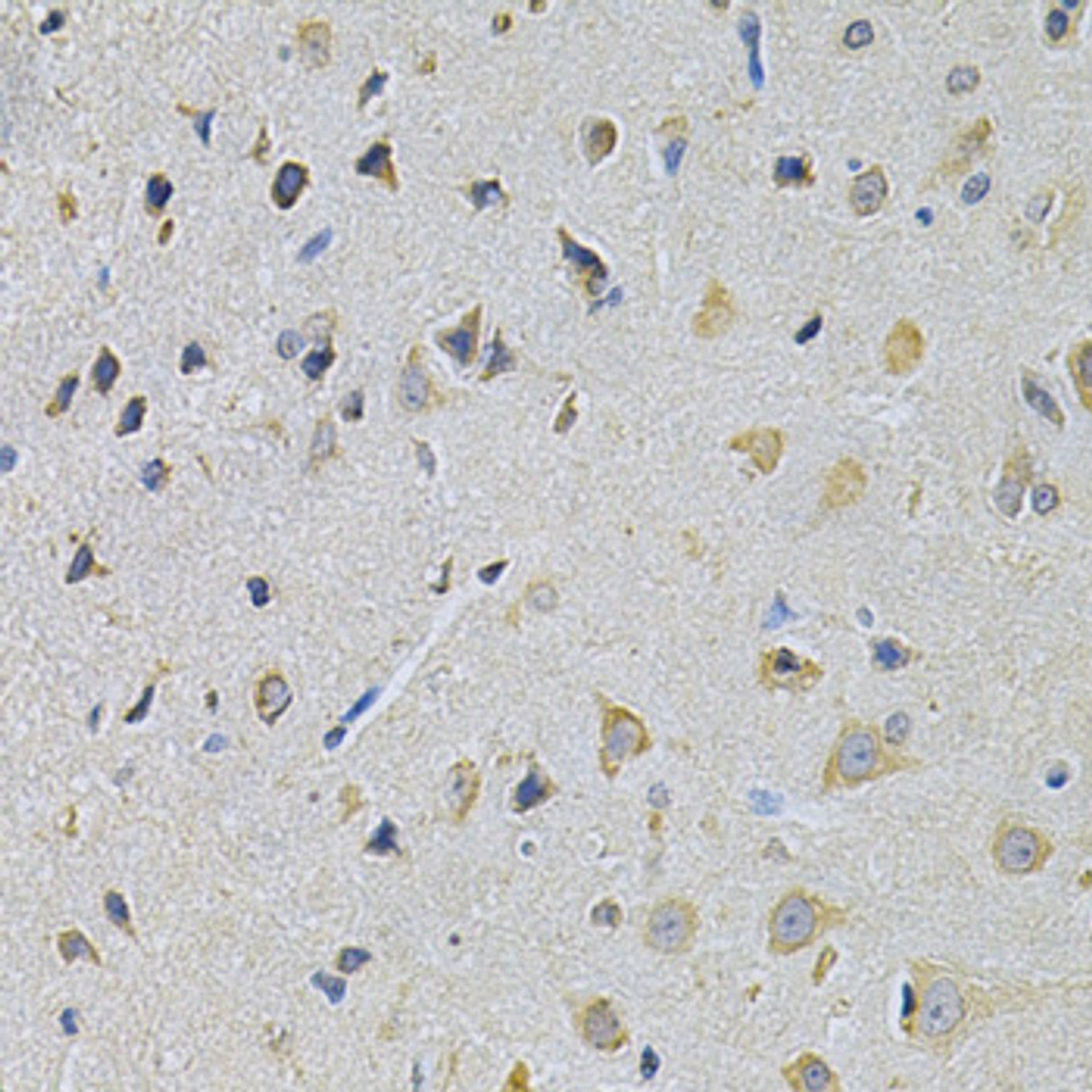 Immunohistochemistry of paraffin-embedded rat brain using PPA1 Antibody (18-507) at dilution of 1:200 (40x lens) .
