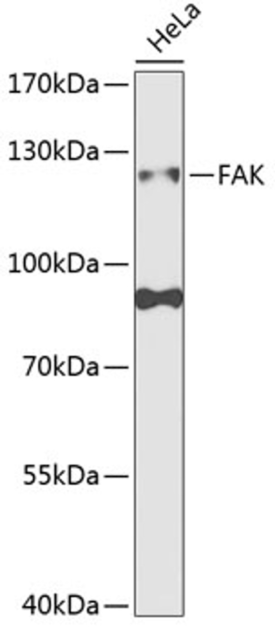 Western blot analysis of extracts of HeLa cells, using FAK antibody (18-512) at 1:1000 dilution.<br/>Secondary antibody: HRP Goat Anti-Rabbit IgG (H+L) at 1:10000 dilution.<br/>Lysates/proteins: 25ug per lane.<br/>Blocking buffer: 3% nonfat dry milk in TBST.<br/>Detection: ECL Basic Kit.<br/>Exposure time: 90s.