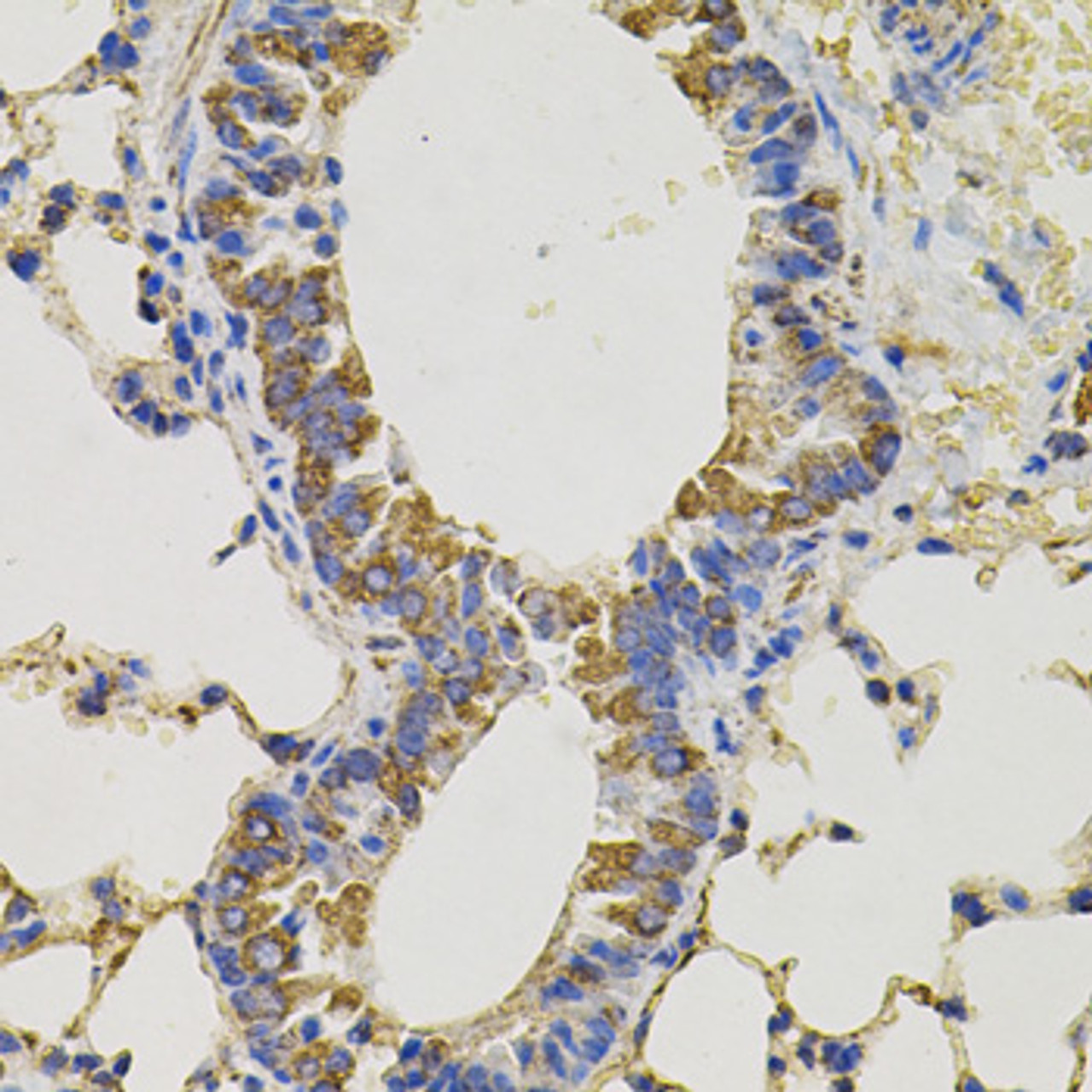 Immunohistochemistry of paraffin-embedded mouse lung using PTPRC antibody (18-513) (40x lens) .