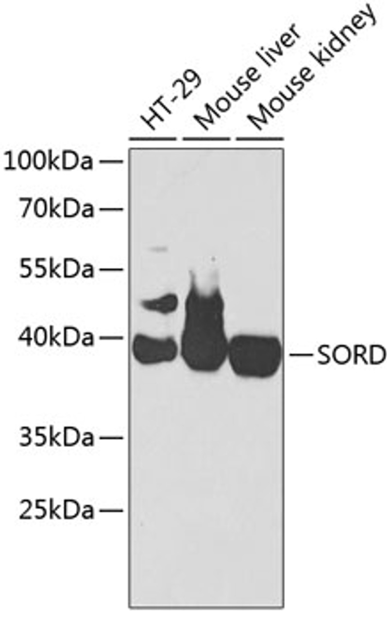 Western blot analysis of extracts of various cell lines, using SORD antibody (18-514) at 1:1000 dilution.<br/>Secondary antibody: HRP Goat Anti-Rabbit IgG (H+L) at 1:10000 dilution.<br/>Lysates/proteins: 25ug per lane.<br/>Blocking buffer: 3% nonfat dry milk in TBST.