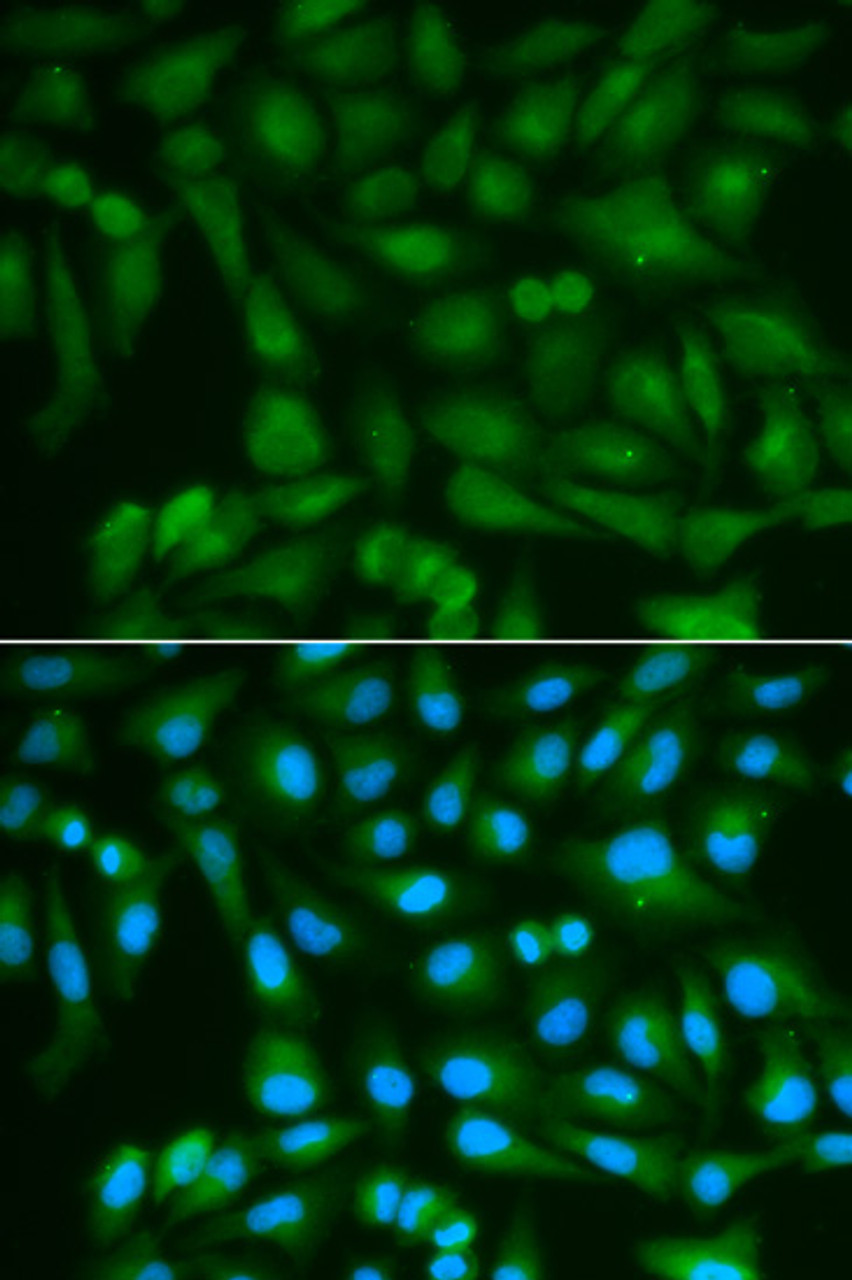 Immunofluorescence analysis of MCF-7 cells using SORD antibody (18-514) . Blue: DAPI for nuclear staining.