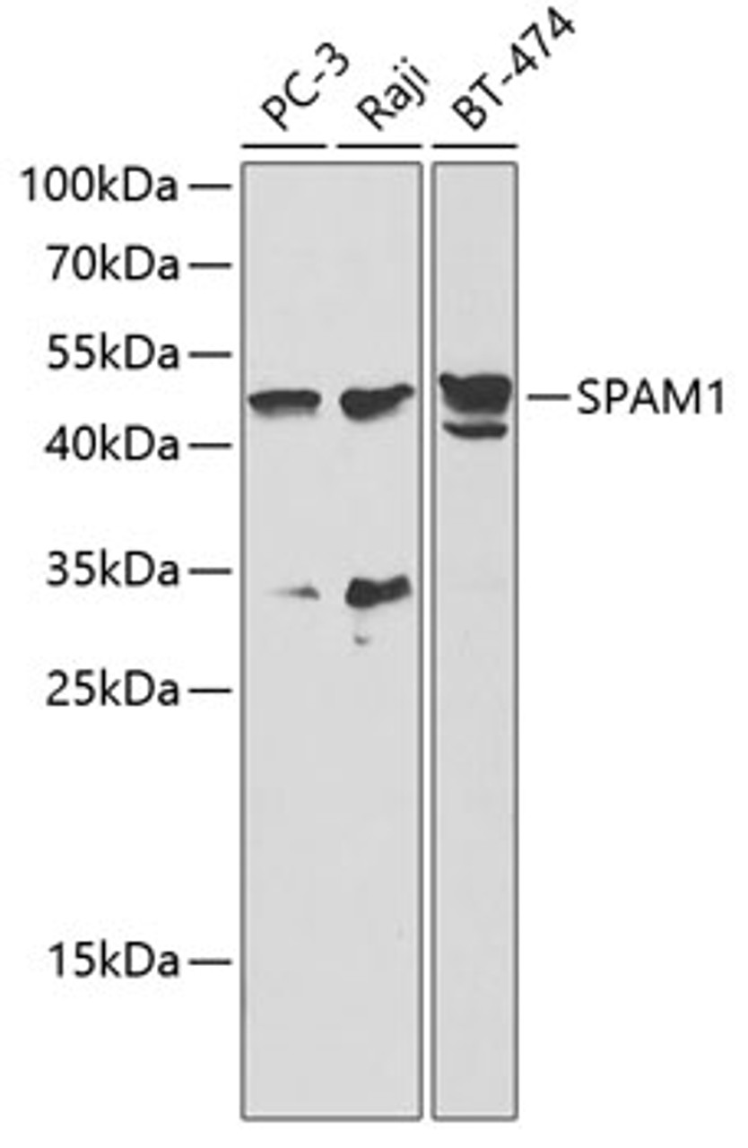 Western blot analysis of extracts of various cell lines, using SPAM1 antibody (18-516) at 1:1000 dilution.<br/>Secondary antibody: HRP Goat Anti-Rabbit IgG (H+L) at 1:10000 dilution.<br/>Lysates/proteins: 25ug per lane.<br/>Blocking buffer: 3% nonfat dry milk in TBST.