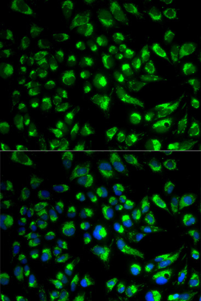 Immunofluorescence analysis of HeLa cells using SPAM1 antibody (18-516) . Blue: DAPI for nuclear staining.