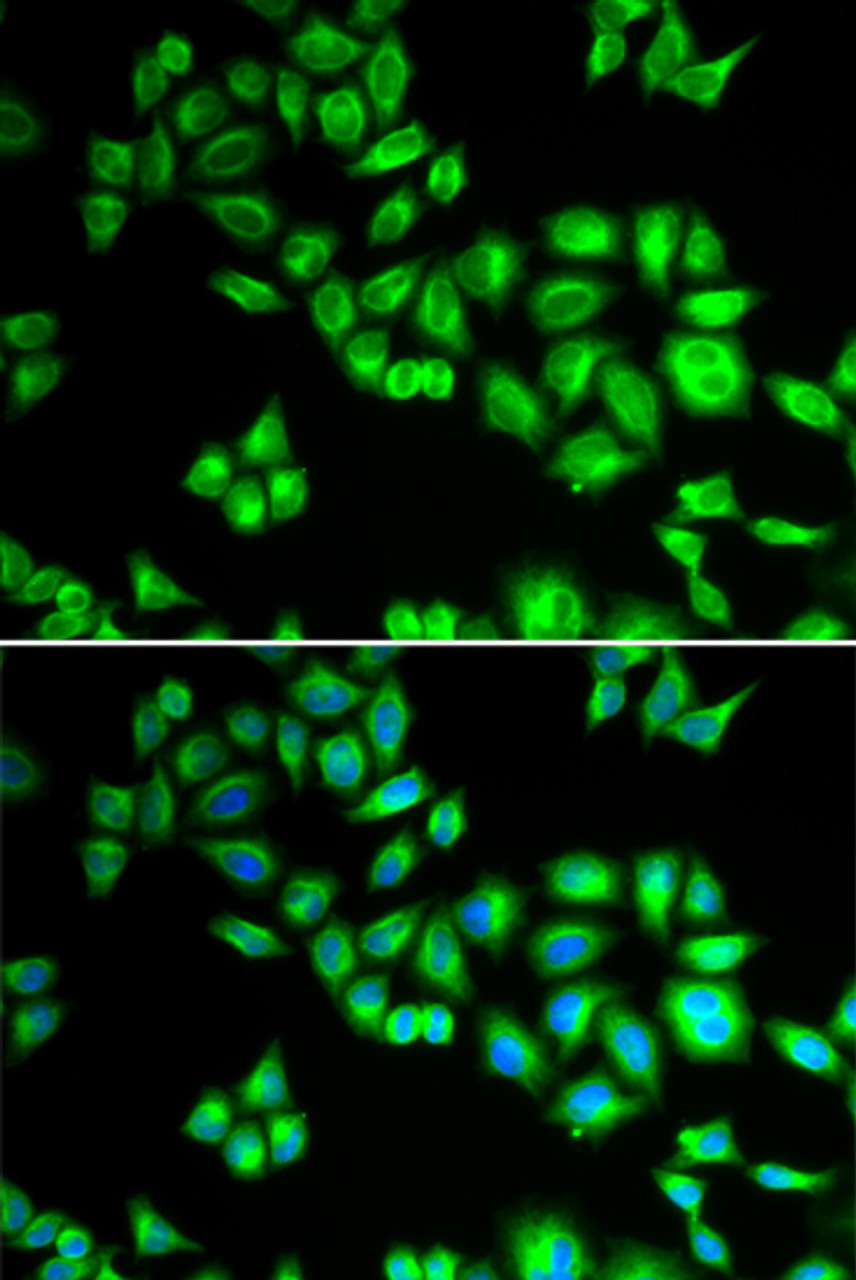 Immunofluorescence analysis of HeLa cells using CUL1 antibody (18-526) . Blue: DAPI for nuclear staining.