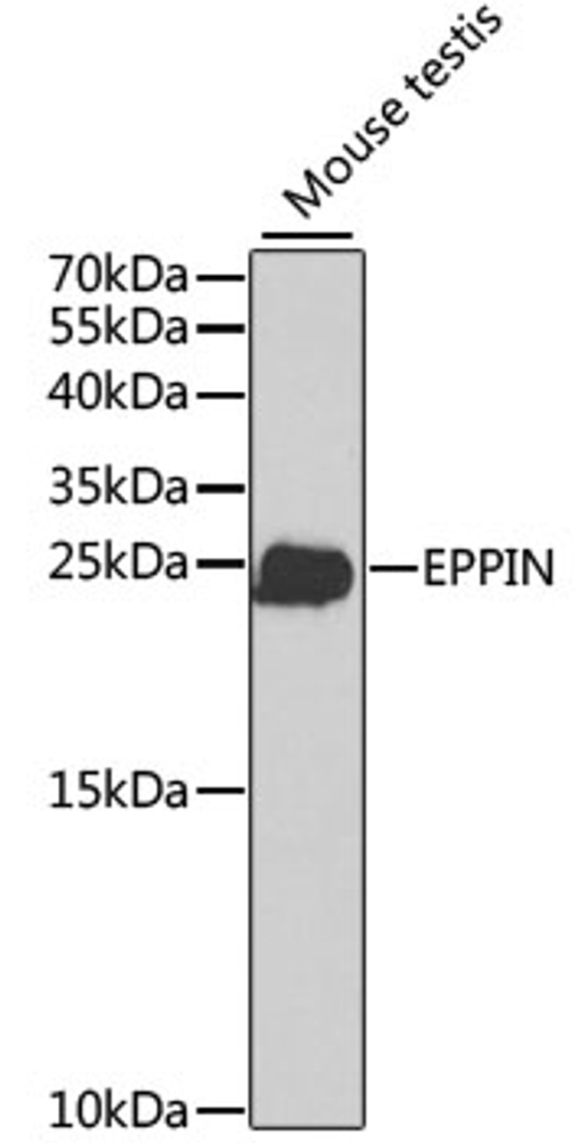 Western blot analysis of extracts of mouse testis, using EPPIN antibody (18-534) at 1:1000 dilution.<br/>Secondary antibody: HRP Goat Anti-Rabbit IgG (H+L) at 1:10000 dilution.<br/>Lysates/proteins: 25ug per lane.<br/>Blocking buffer: 3% nonfat dry milk in TBST.<br/>Detection: ECL Basic Kit.