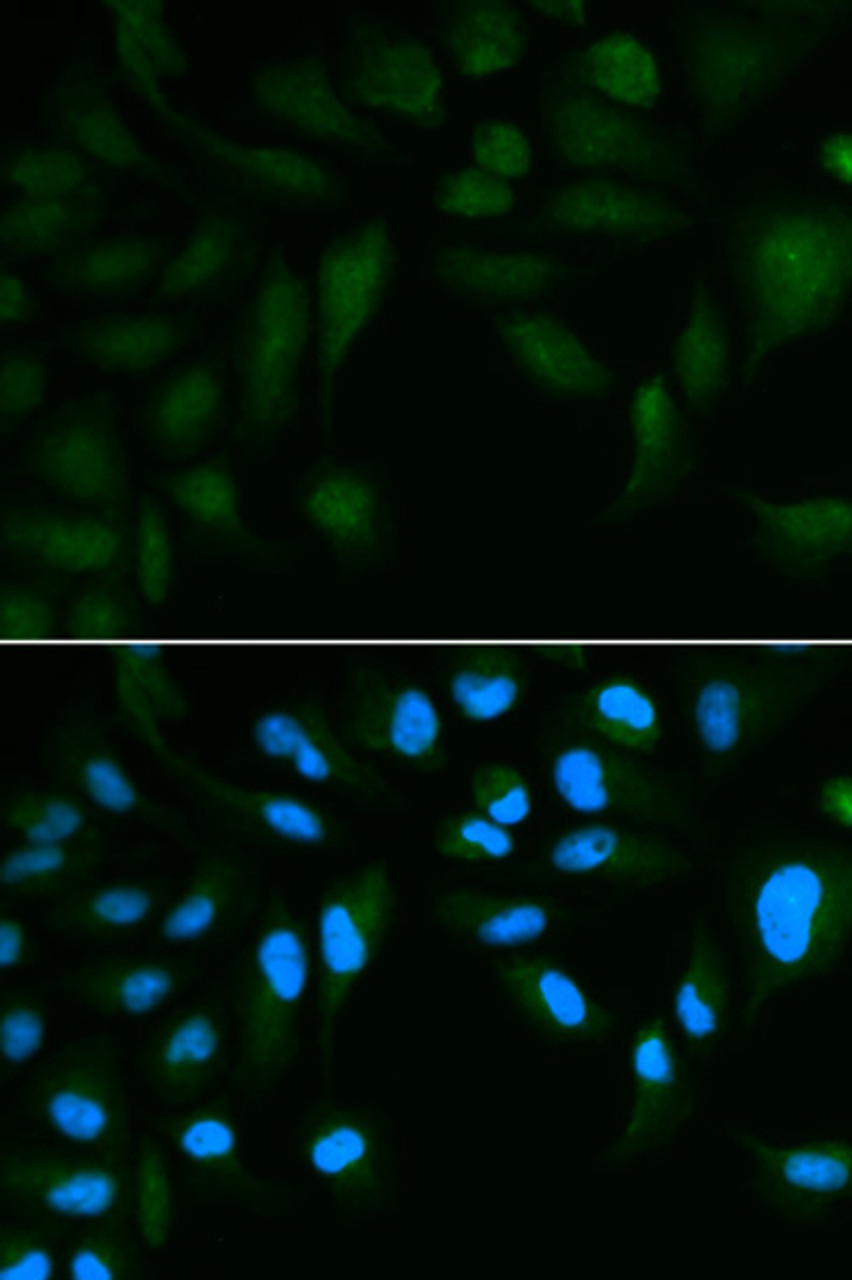 Immunofluorescence analysis of HepG2 cells using EPPIN antibody (18-534) . Blue: DAPI for nuclear staining.
