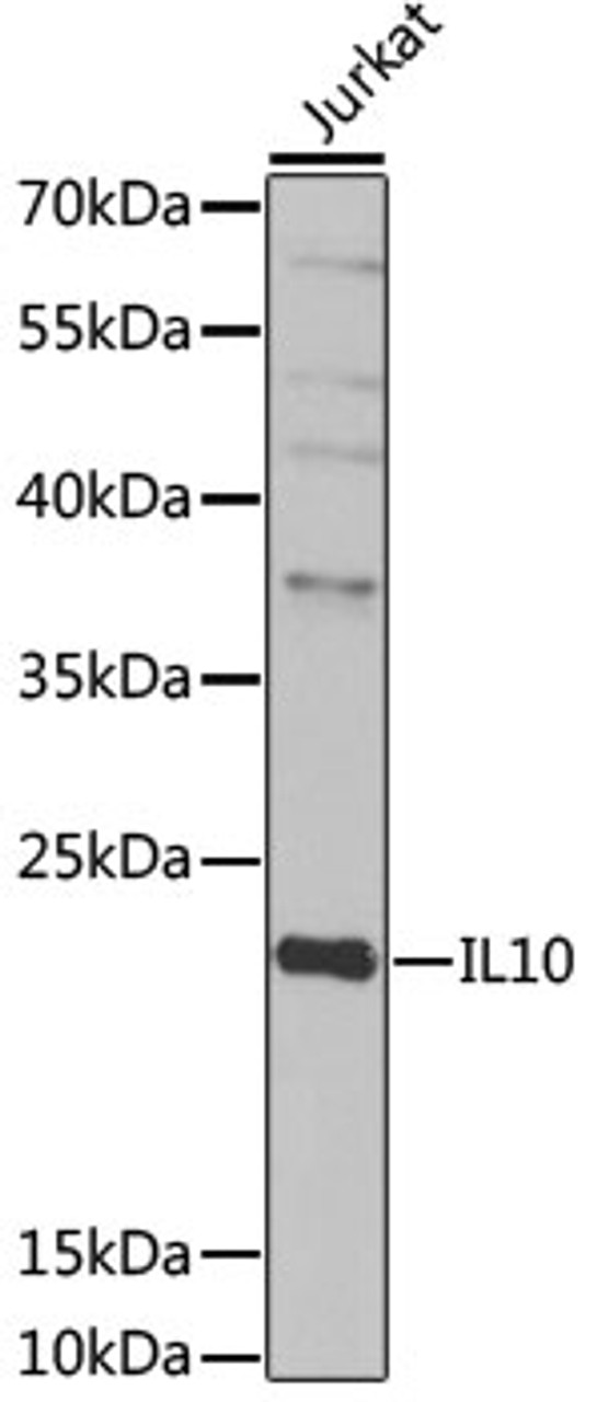 Western blot analysis of extracts of Jurkat cells, using IL10 antibody (18-551) at 1:1000 dilution.<br/>Secondary antibody: HRP Goat Anti-Rabbit IgG (H+L) at 1:10000 dilution.<br/>Lysates/proteins: 25ug per lane.<br/>Blocking buffer: 3% nonfat dry milk in TBST.<br/>Detection: ECL Enhanced Kit.<br/>Exposure time: 10s.