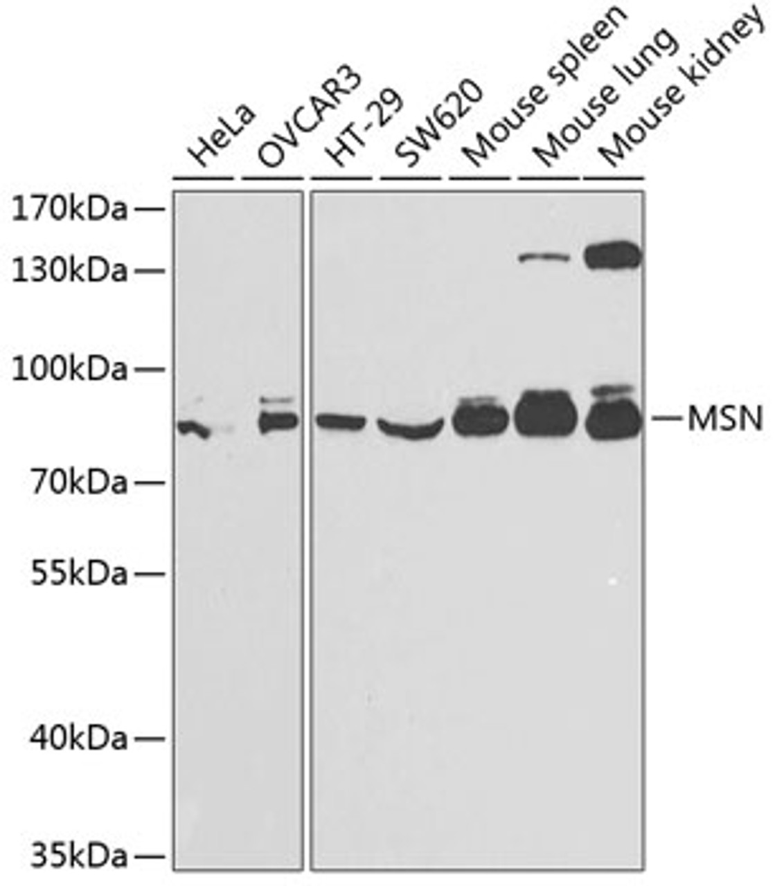 Western blot analysis of extracts of various cell lines, using MSN antibody (18-553) at 1:1000 dilution.<br/>Secondary antibody: HRP Goat Anti-Rabbit IgG (H+L) at 1:10000 dilution.<br/>Lysates/proteins: 25ug per lane.<br/>Blocking buffer: 3% nonfat dry milk in TBST.