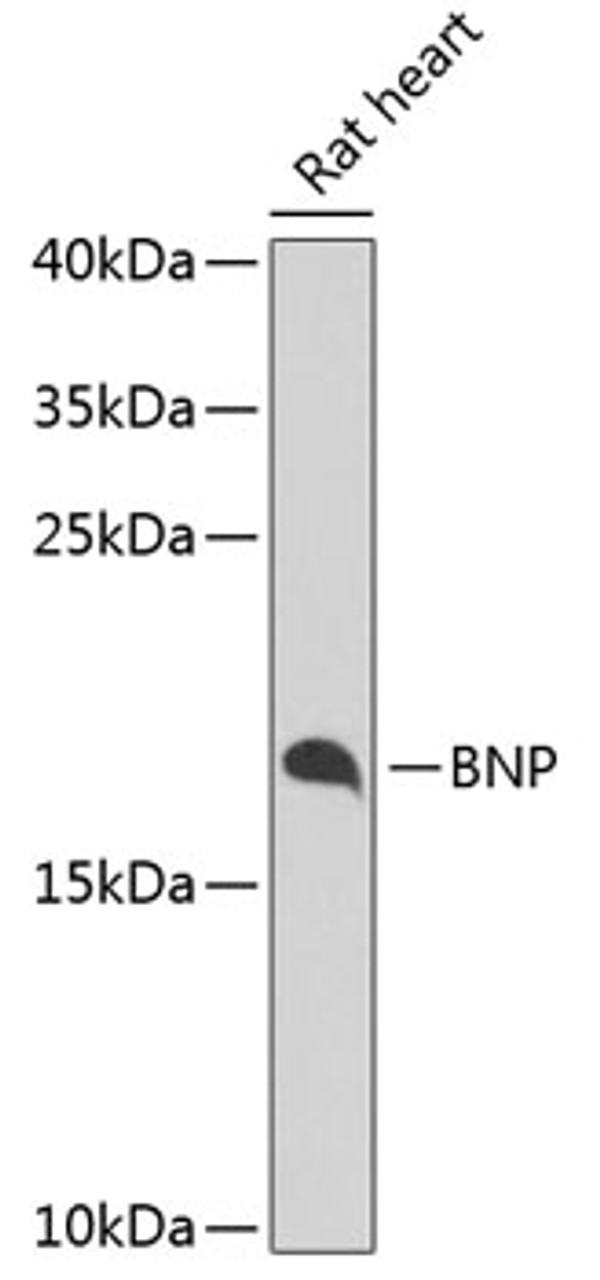 Western blot analysis of extracts of rat heart, using BNP antibody (18-554) at 1:1000 dilution.<br/>Secondary antibody: HRP Goat Anti-Rabbit IgG (H+L) at 1:10000 dilution.<br/>Lysates/proteins: 25ug per lane.<br/>Blocking buffer: 3% nonfat dry milk in TBST.<br/>Detection: ECL Enhanced Kit.<br/>Exposure time: 30s.