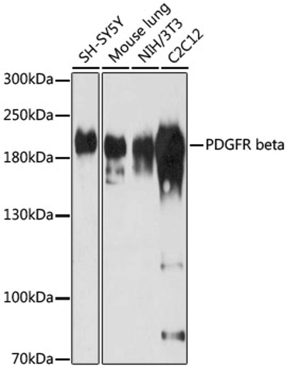 Western blot analysis of extracts of various cell lines, using PDGFR beta antibody (18-555) at 1:1000 dilution.<br/>Secondary antibody: HRP Goat Anti-Rabbit IgG (H+L) at 1:10000 dilution.<br/>Lysates/proteins: 25ug per lane.<br/>Blocking buffer: 3% nonfat dry milk in TBST.<br/>Detection: ECL Basic Kit.<br/>Exposure time: 3min.