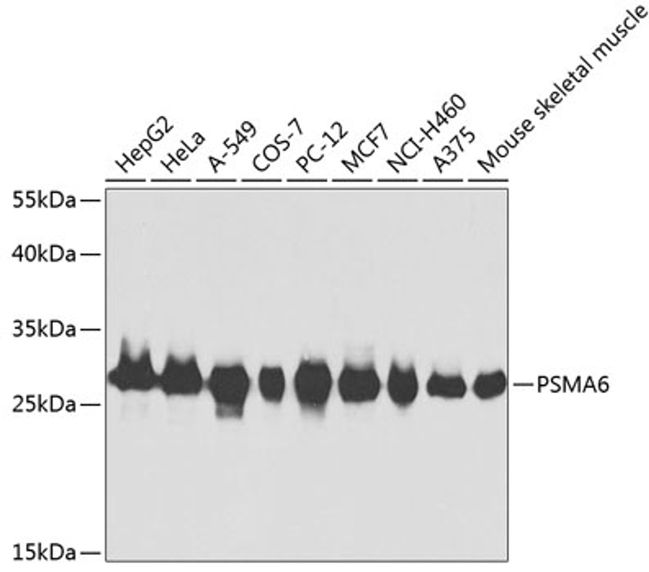 Western blot analysis of extracts of various cell lines, using PSMA6 antibody (18-561) at 1:1000 dilution.<br/>Secondary antibody: HRP Goat Anti-Rabbit IgG (H+L) at 1:10000 dilution.<br/>Lysates/proteins: 25ug per lane.<br/>Blocking buffer: 3% nonfat dry milk in TBST.