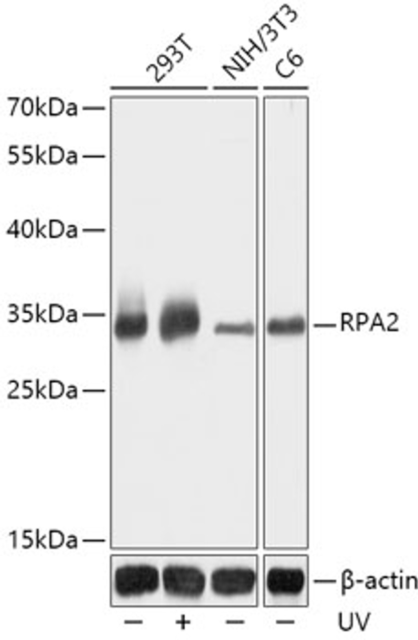 Western blot analysis of extracts of various cell lines, using RPA2 antibody (18-562) at 1:1000 dilution. 293T cells were treated by UV at room temperature for 15-30 minutes.<br/>Secondary antibody: HRP Goat Anti-Rabbit IgG (H+L) at 1:10000 dilution.<br/>Lysates/proteins: 25ug per lane.<br/>Blocking buffer: 3% nonfat dry milk in TBST.<br/>Detection: ECL Basic Kit.<br/>Exposure time: 10s.