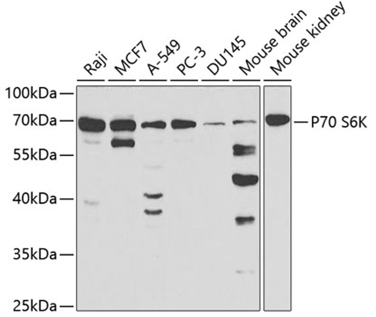 Western blot analysis of extracts of various cell lines, using P70 S6K antibody (18-563) at 1:1000 dilution.<br/>Secondary antibody: HRP Goat Anti-Rabbit IgG (H+L) at 1:10000 dilution.<br/>Lysates/proteins: 25ug per lane.<br/>Blocking buffer: 3% nonfat dry milk in TBST.