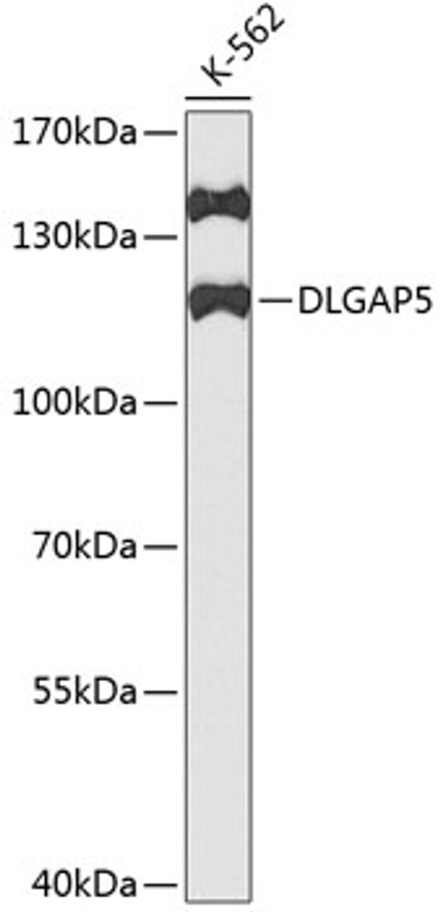 Western blot analysis of extracts of K562 cells, using DLGAP5 antibody (18-568) at 1:1000 dilution.<br/>Secondary antibody: HRP Goat Anti-Rabbit IgG (H+L) at 1:10000 dilution.<br/>Lysates/proteins: 25ug per lane.<br/>Blocking buffer: 3% nonfat dry milk in TBST.<br/>Detection: ECL Basic Kit.<br/>Exposure time: 90s.