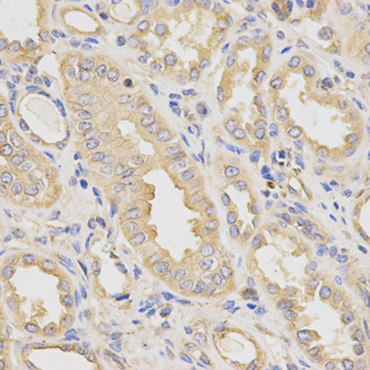 Immunohistochemistry of paraffin-embedded human kidney using DCTN2 antibody (18-570) at dilution of 1:200 (40x lens) .