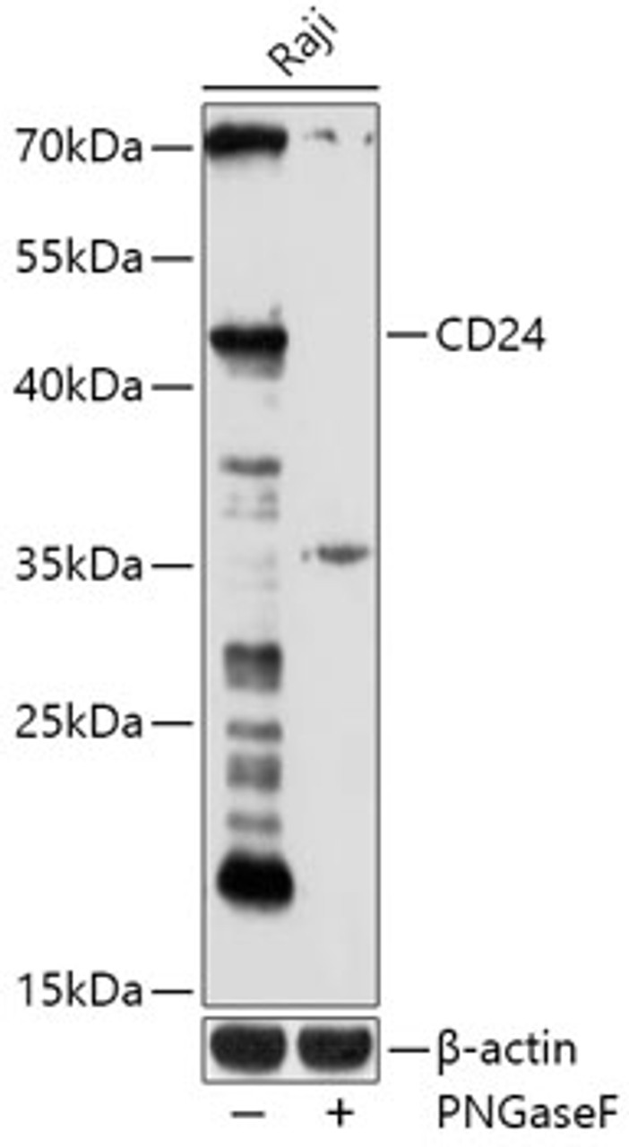 Western blot analysis of extracts of Raji cells, using CD24 antibody (18-574) at 1:1000 dilution.<br/>Secondary antibody: HRP Goat Anti-Rabbit IgG (H+L) at 1:10000 dilution.<br/>Lysates/proteins: 25ug per lane.<br/>Blocking buffer: 3% nonfat dry milk in TBST.<br/>Detection: ECL Basic Kit.<br/>Exposure time: 180s.