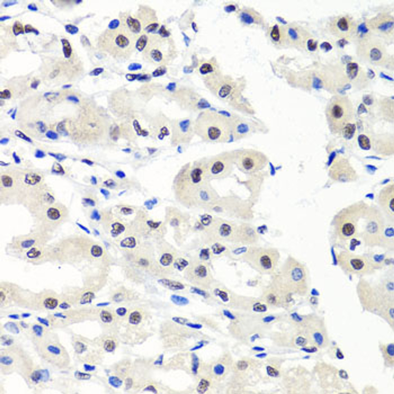Immunohistochemistry of paraffin-embedded human stomach using CBX1 antibody (18-587) at dilution of 1:100 (40x lens) .