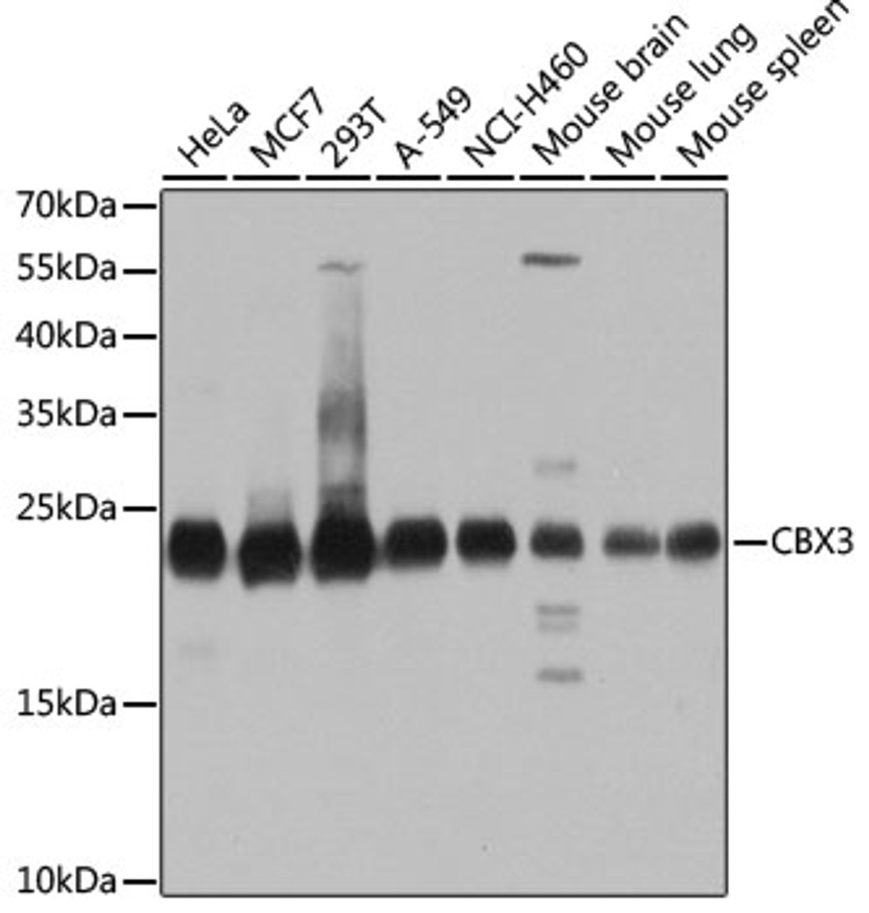 Western blot analysis of extracts of various cell lines, using CBX3 antibody (18-588) at 1:1000 dilution.<br/>Secondary antibody: HRP Goat Anti-Rabbit IgG (H+L) at 1:10000 dilution.<br/>Lysates/proteins: 25ug per lane.<br/>Blocking buffer: 3% nonfat dry milk in TBST.<br/>Detection: ECL Basic Kit.<br/>Exposure time: 5s.