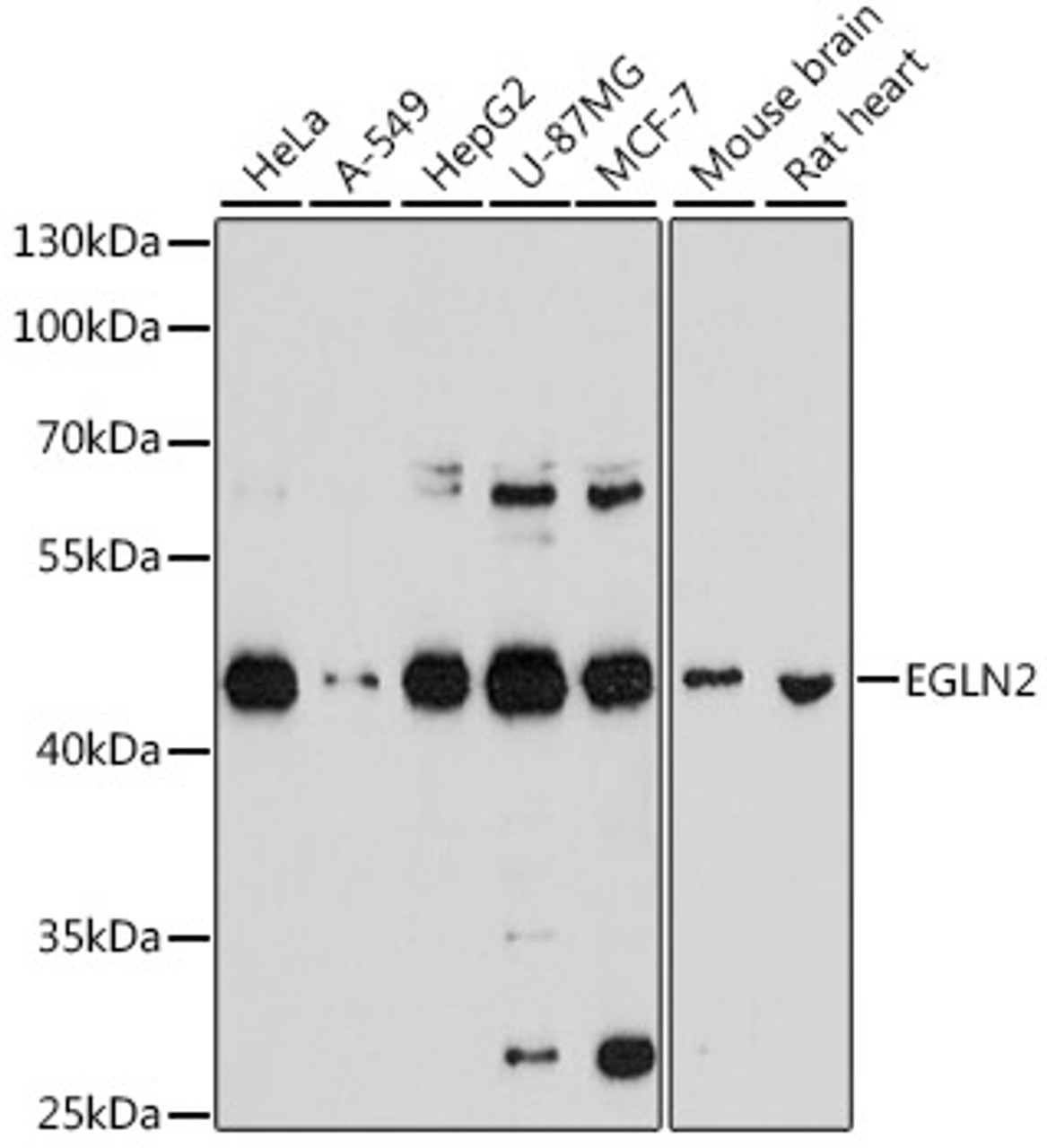 Western blot analysis of extracts of various cell lines, using EGLN2 antibody (18-590) at 1:1000 dilution.<br/>Secondary antibody: HRP Goat Anti-Rabbit IgG (H+L) at 1:10000 dilution.<br/>Lysates/proteins: 25ug per lane.<br/>Blocking buffer: 3% nonfat dry milk in TBST.<br/>Detection: ECL Basic Kit.<br/>Exposure time: 30s.