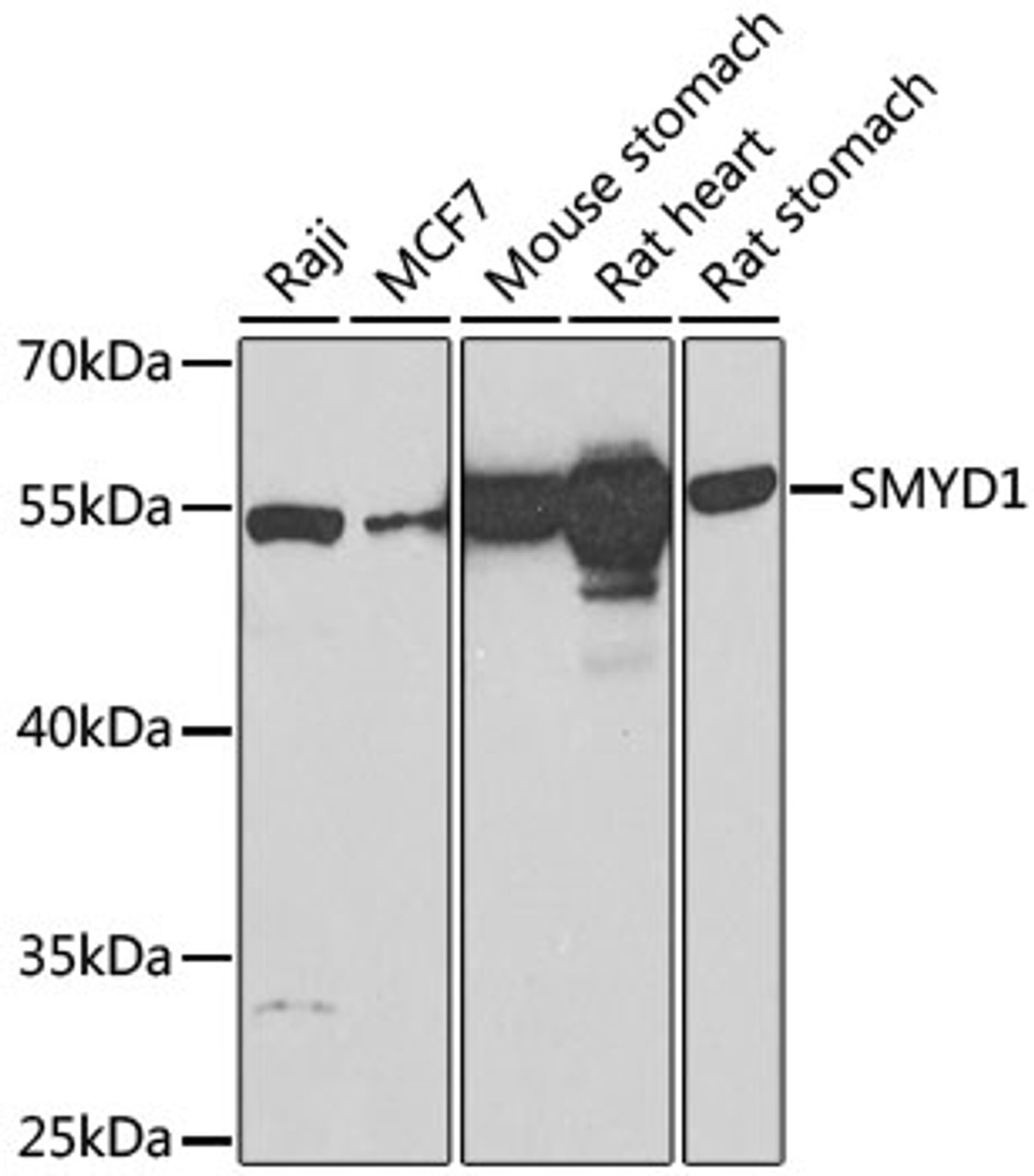 Western blot analysis of extracts of various cell lines, using SMYD1 Antibody (18-611) at 1:1000 dilution.<br/>Secondary antibody: HRP Goat Anti-Rabbit IgG (H+L) at 1:10000 dilution.<br/>Lysates/proteins: 25ug per lane.<br/>Blocking buffer: 3% nonfat dry milk in TBST.<br/>Detection: ECL Basic Kit.<br/>Exposure time: 60s.