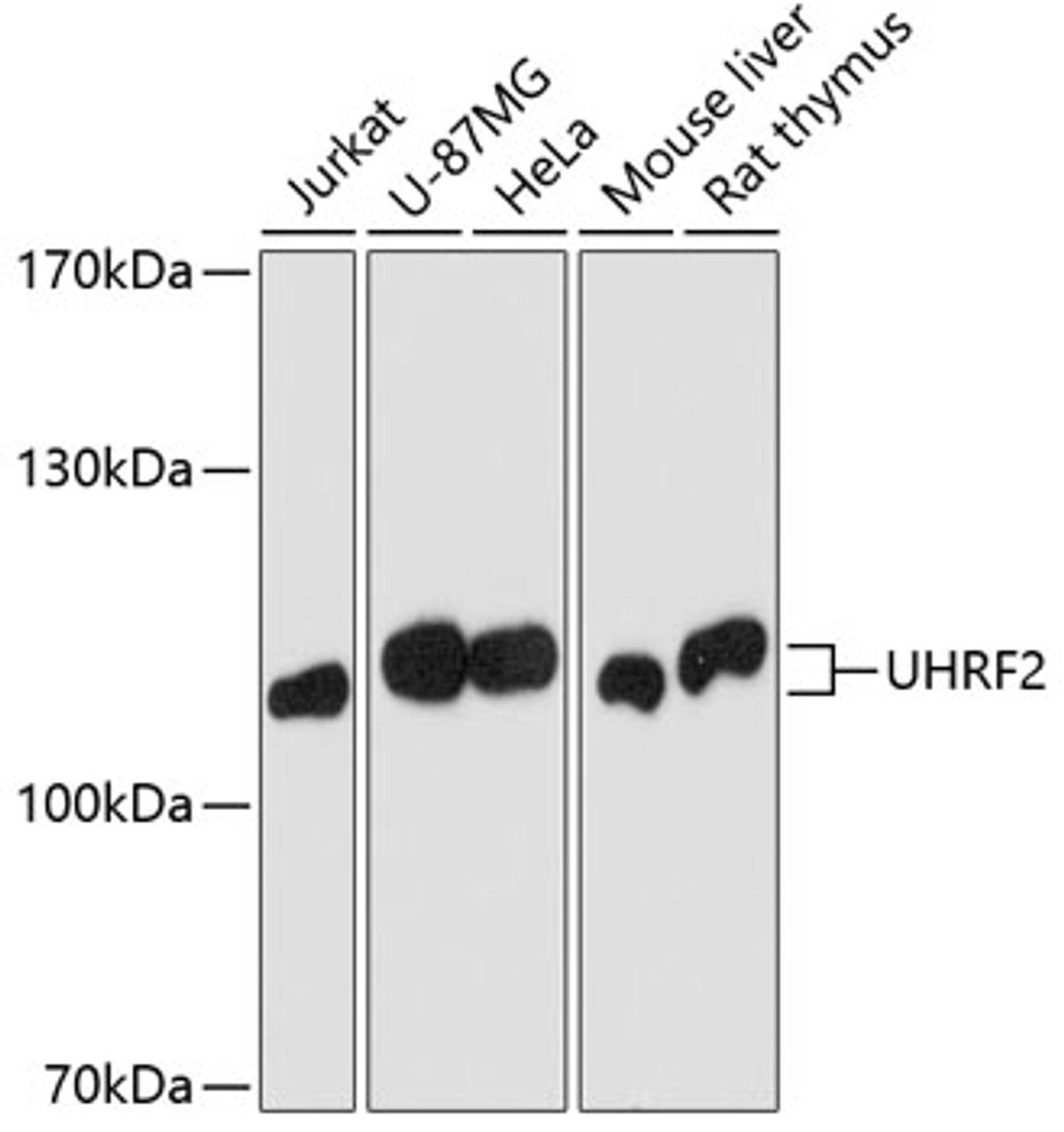 Western blot analysis of extracts of various cell lines, using UHRF2 antibody (18-614) at 1:1000 dilution.<br/>Secondary antibody: HRP Goat Anti-Rabbit IgG (H+L) at 1:10000 dilution.<br/>Lysates/proteins: 25ug per lane.<br/>Blocking buffer: 3% nonfat dry milk in TBST.<br/>Detection: ECL Basic Kit.<br/>Exposure time: 90s.