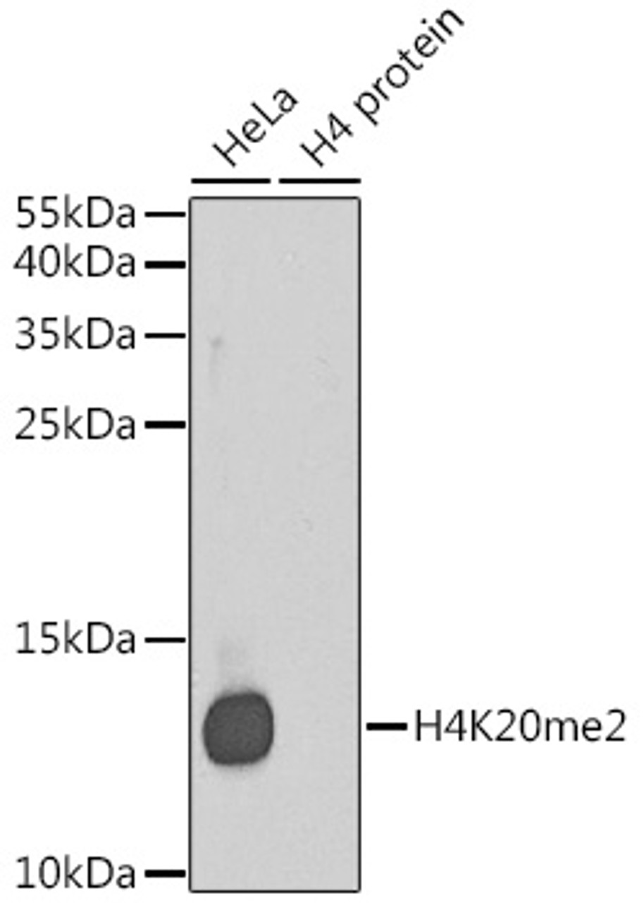 Western blot analysis of extracts of various cell lines, using DiMethyl-Histone H4-K20 antibody (18-634) .<br/>Secondary antibody: HRP Goat Anti-Rabbit IgG (H+L) at 1:10000 dilution.<br/>Lysates/proteins: 25ug per lane.<br/>Blocking buffer: 3% nonfat dry milk in TBST.