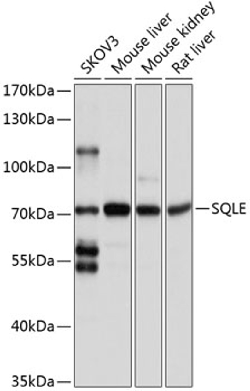 Western blot analysis of extracts of various cell lines, using SQLE antibody (18-645) at 1:1000 dilution.<br/>Secondary antibody: HRP Goat Anti-Rabbit IgG (H+L) at 1:10000 dilution.<br/>Lysates/proteins: 25ug per lane.<br/>Blocking buffer: 3% nonfat dry milk in TBST.<br/>Detection: ECL Basic Kit.<br/>Exposure time: 5s.