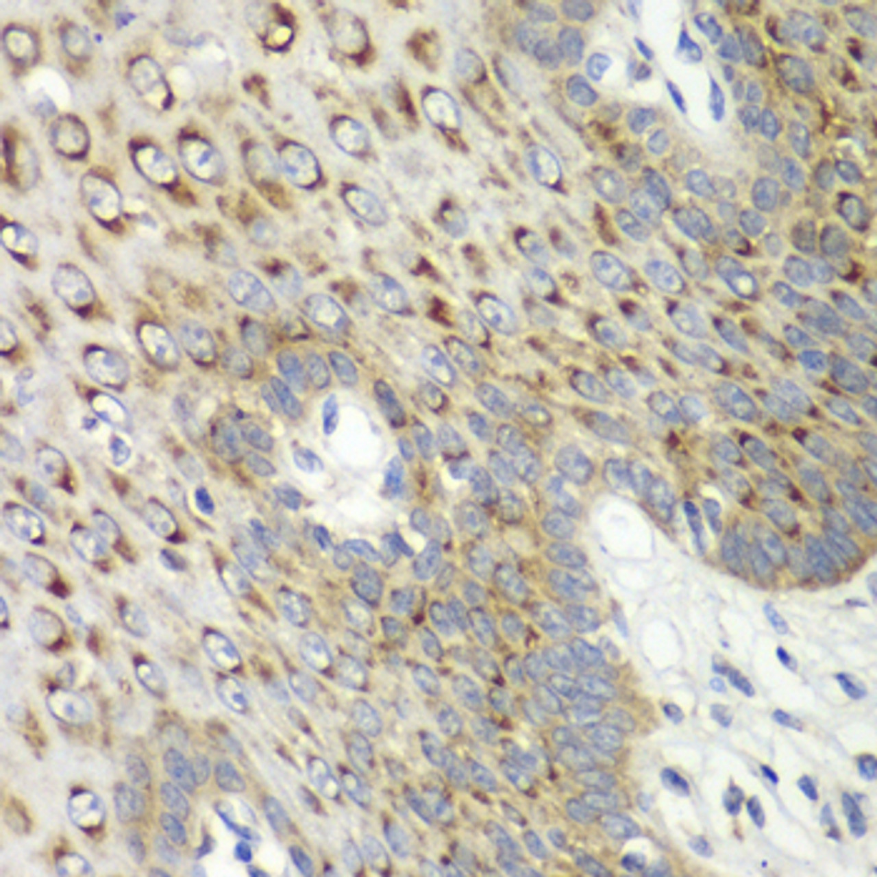 Immunohistochemistry of paraffin-embedded human esophagus using CDK1 antibody (18-647) at dilution of 1:100 (40x lens) .