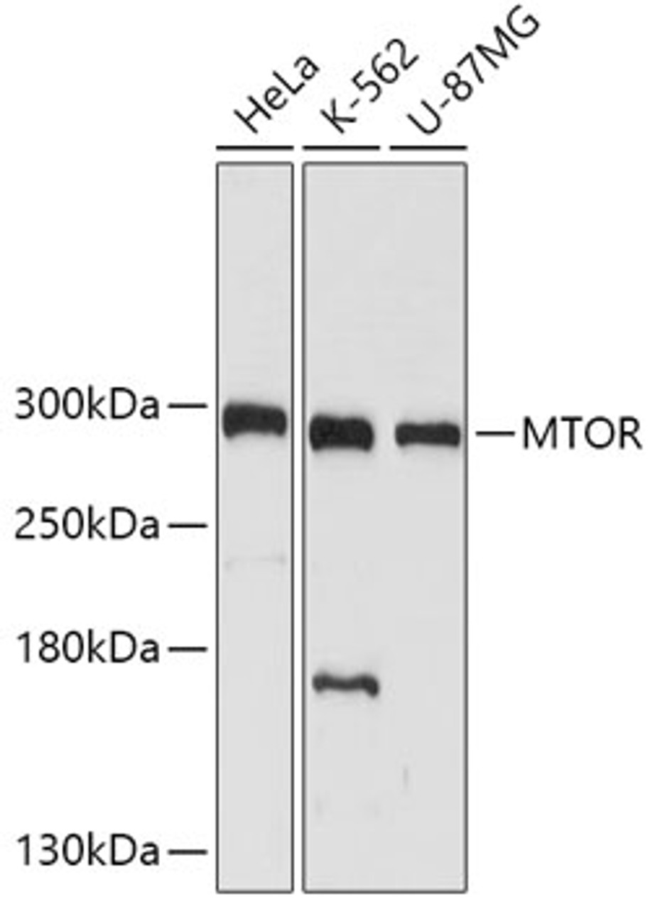 Western blot analysis of extracts of various cell lines, using mTOR antibody (18-651) at 1:1000 dilution.<br/>Secondary antibody: HRP Goat Anti-Rabbit IgG (H+L) at 1:10000 dilution.<br/>Lysates/proteins: 25ug per lane.<br/>Blocking buffer: 3% nonfat dry milk in TBST.<br/>Detection: ECL Basic Kit.<br/>Exposure time: 10s.