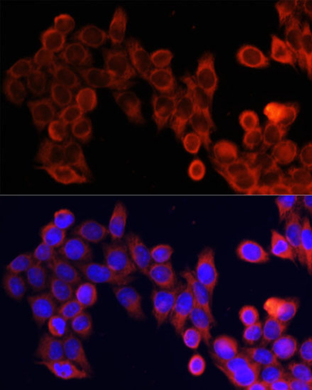 Immunofluorescence analysis of HeLa cells using mTOR antibody (18-651) at dilution of 1:100. Blue: DAPI for nuclear staining.