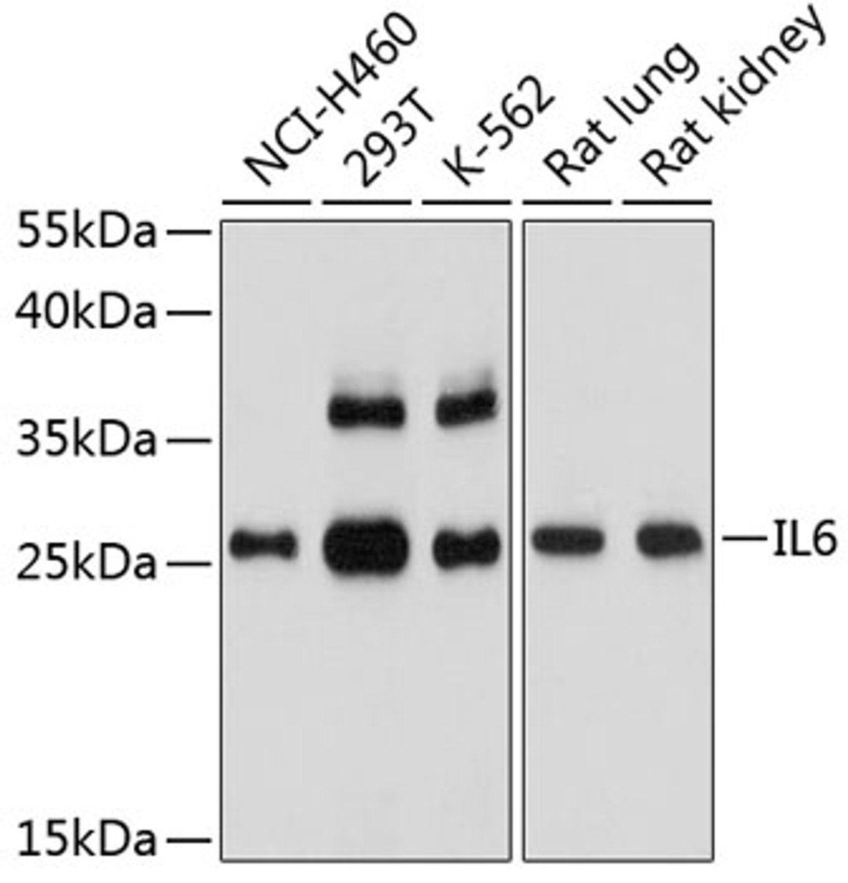 Western blot analysis of extracts of various cell lines, using IL6 antibody (18-652) at 1:1000 dilution.<br/>Secondary antibody: HRP Goat Anti-Rabbit IgG (H+L) at 1:10000 dilution.<br/>Lysates/proteins: 25ug per lane.<br/>Blocking buffer: 3% nonfat dry milk in TBST.<br/>Detection: ECL Basic Kit.<br/>Exposure time: 90s.