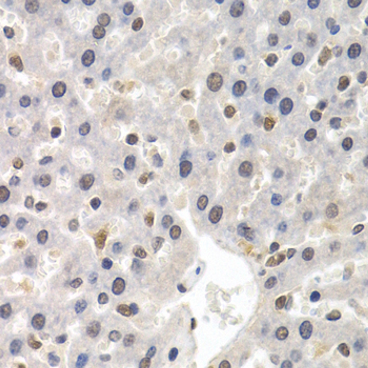 Immunohistochemistry of paraffin-embedded rat liver using GTF2F1 antibody (18-663) at dilution of 1:200 (40x lens) .