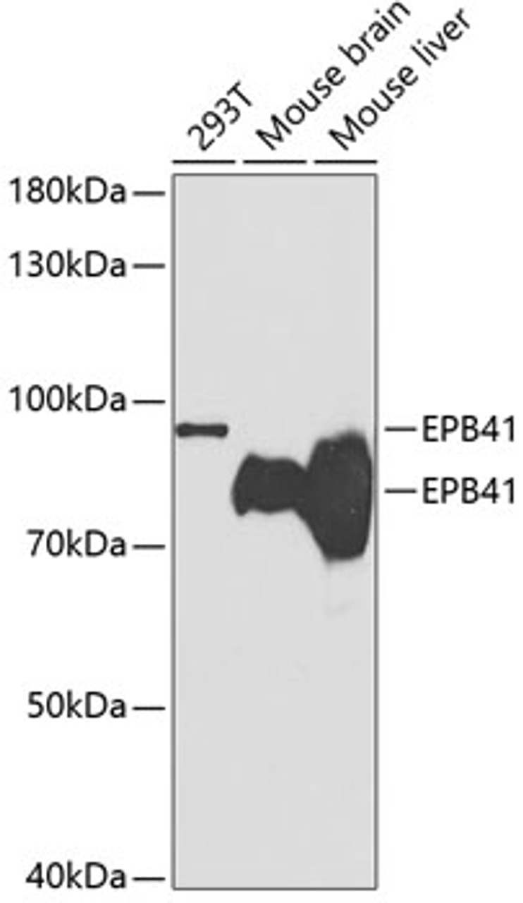 Western blot analysis of extracts of various cell lines, using EPB41 antibody (18-664) at 1:1000 dilution.<br/>Secondary antibody: HRP Goat Anti-Rabbit IgG (H+L) at 1:10000 dilution.<br/>Lysates/proteins: 25ug per lane.<br/>Blocking buffer: 3% nonfat dry milk in TBST.