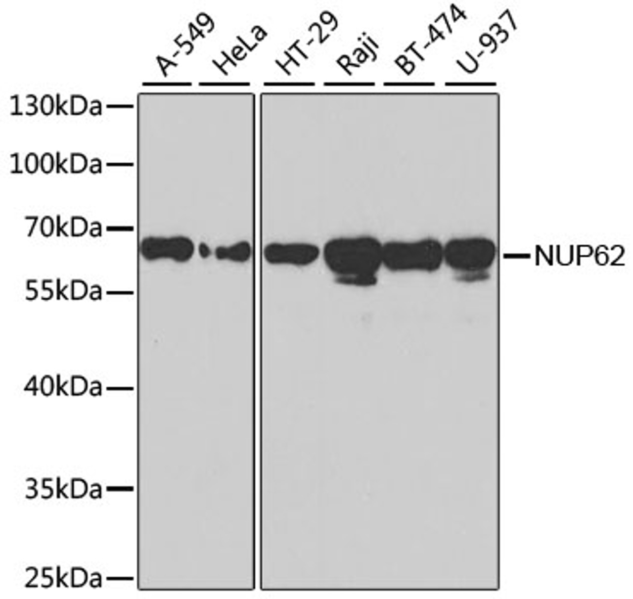 Western blot analysis of extracts of various cell lines, using NUP62 antibody (18-670) at 1:1000 dilution.<br/>Secondary antibody: HRP Goat Anti-Rabbit IgG (H+L) at 1:10000 dilution.<br/>Lysates/proteins: 25ug per lane.<br/>Blocking buffer: 3% nonfat dry milk in TBST.<br/>Detection: ECL Basic Kit.
