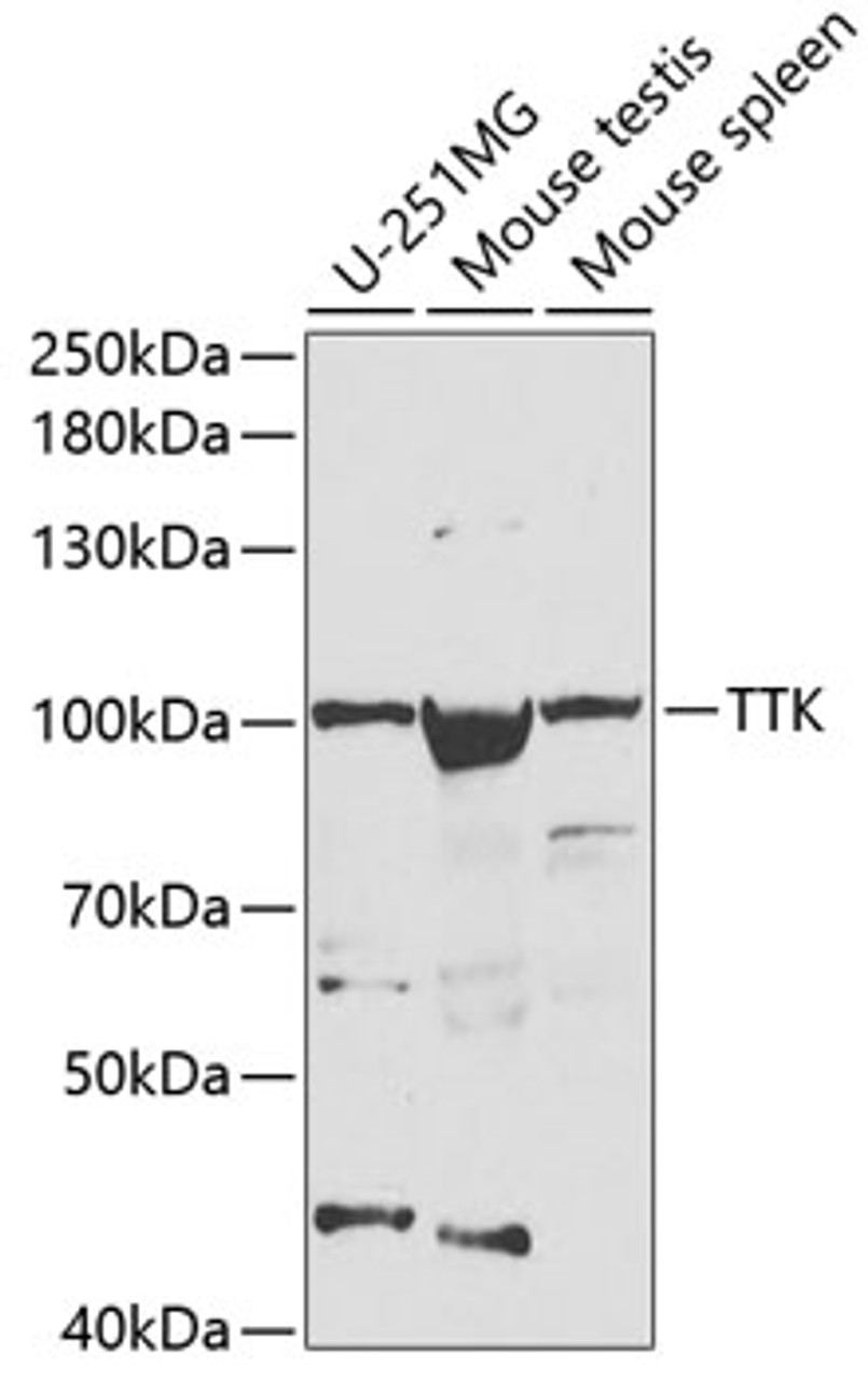 Western blot analysis of extracts of various cell lines, using TTK antibody (18-671) at 1:1000 dilution.<br/>Secondary antibody: HRP Goat Anti-Rabbit IgG (H+L) at 1:10000 dilution.<br/>Lysates/proteins: 25ug per lane.<br/>Blocking buffer: 3% nonfat dry milk in TBST.<br/>Detection: ECL Basic Kit.<br/>Exposure time: 90s.
