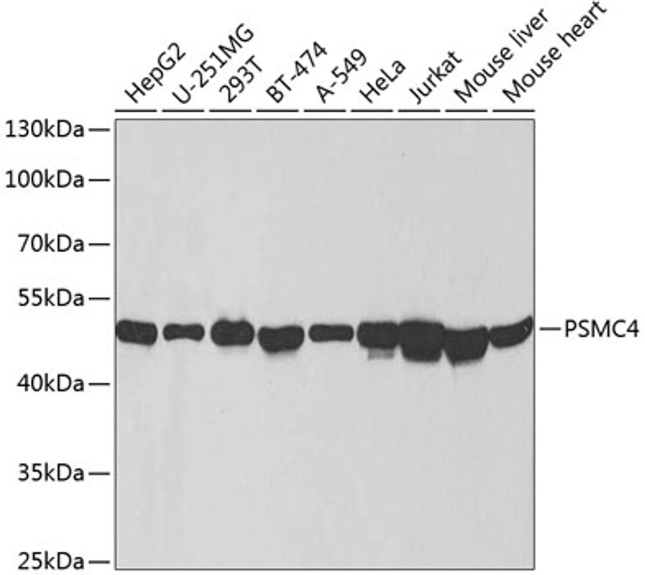 Western blot analysis of extracts of various cell lines, using PSMC4 antibody (18-674) at 1:1000 dilution.<br/>Secondary antibody: HRP Goat Anti-Rabbit IgG (H+L) at 1:10000 dilution.<br/>Lysates/proteins: 25ug per lane.<br/>Blocking buffer: 3% nonfat dry milk in TBST.<br/>Detection: ECL Basic Kit.<br/>Exposure time: 30s.