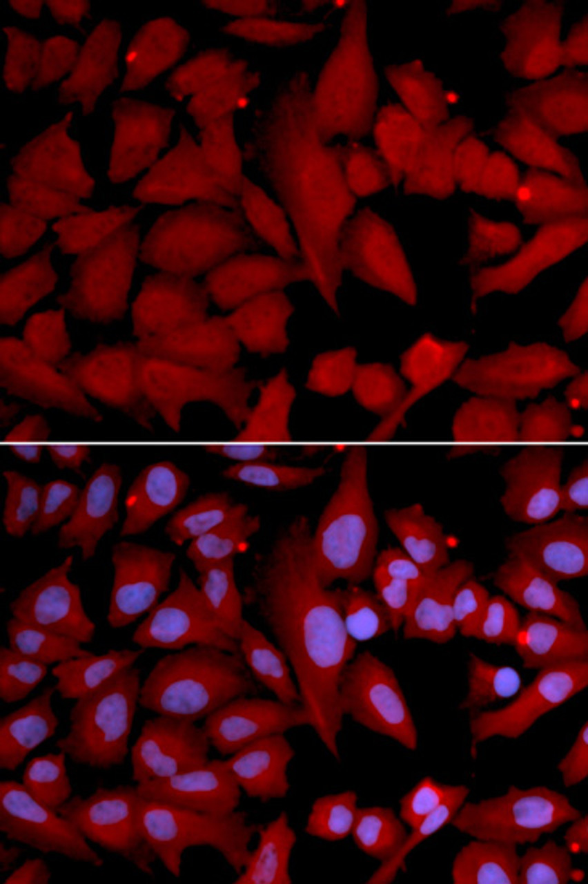 Immunofluorescence analysis of U2OS cells using PSMA4 antibody (18-680) . Blue: DAPI for nuclear staining.