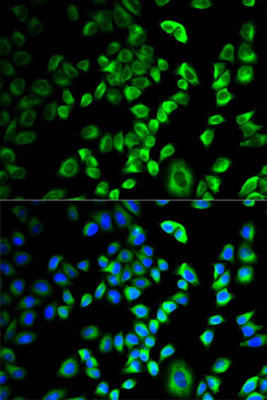 Immunofluorescence analysis of HeLa cells using SERPINH1 antibody (18-682) . Blue: DAPI for nuclear staining.