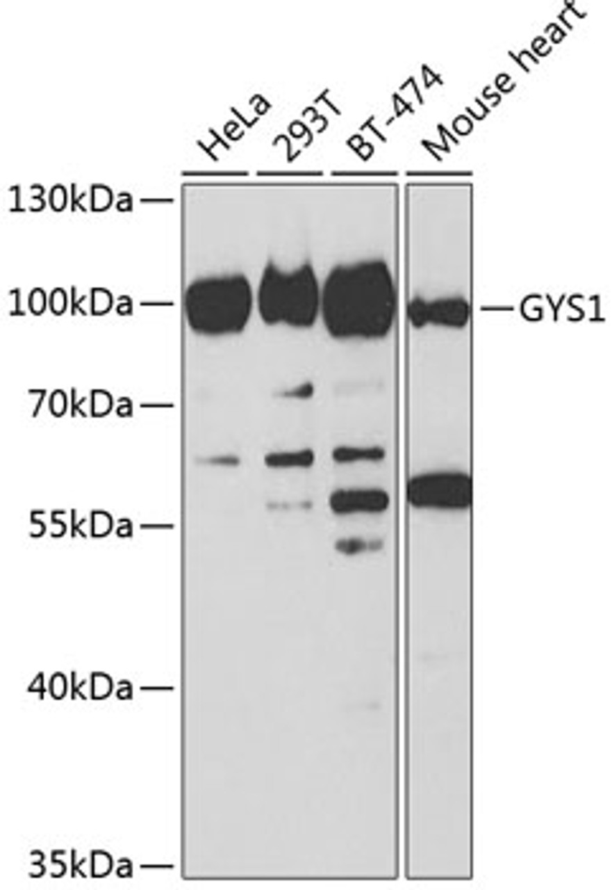 Western blot analysis of extracts of various cell lines, using GYS1 antibody (18-683) at 1:1000 dilution.<br/>Secondary antibody: HRP Goat Anti-Rabbit IgG (H+L) at 1:10000 dilution.<br/>Lysates/proteins: 25ug per lane.<br/>Blocking buffer: 3% nonfat dry milk in TBST.<br/>Detection: ECL Basic Kit.<br/>Exposure time: 30s.