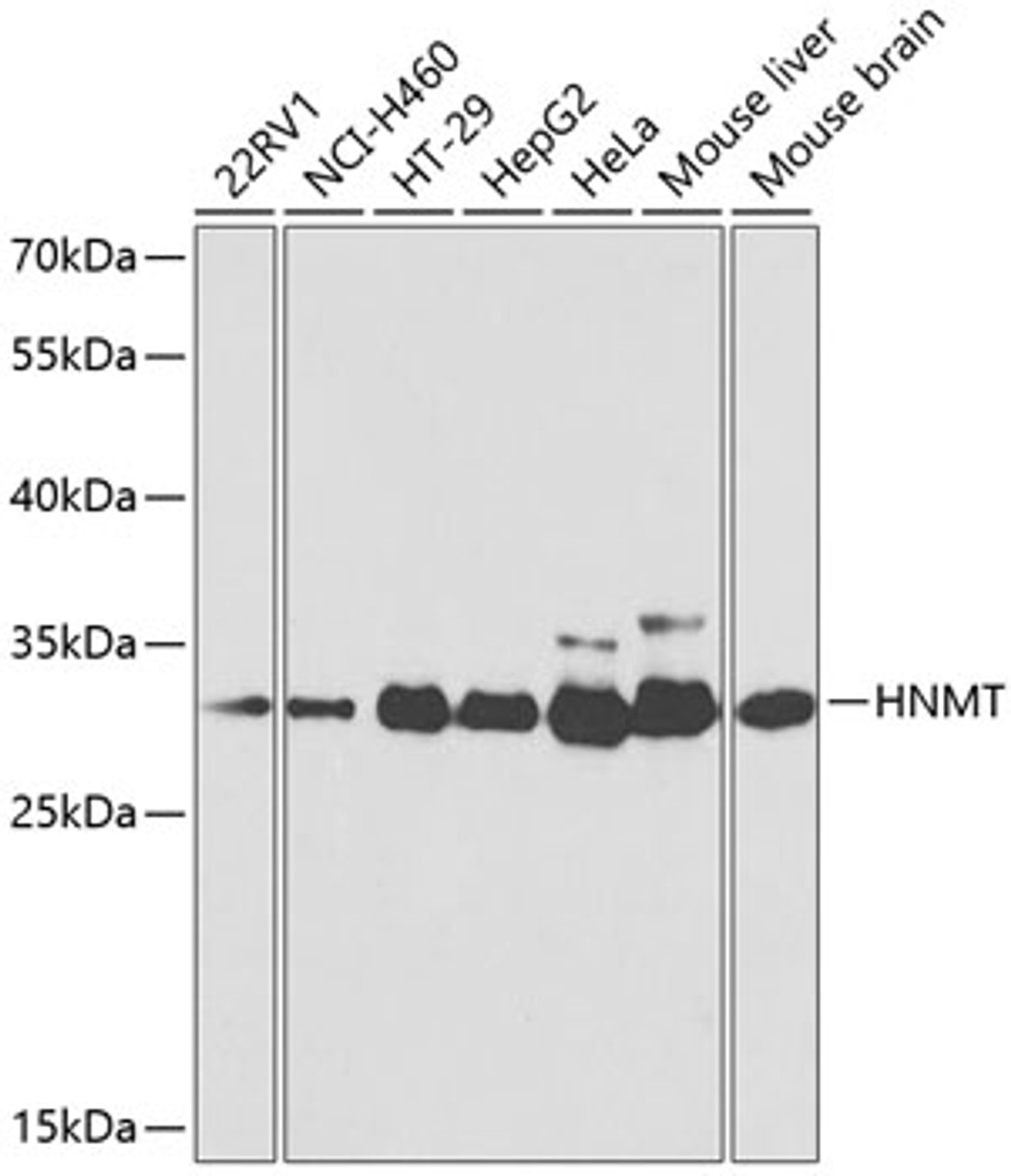 Western blot analysis of extracts of various cell lines, using HNMT antibody (18-684) at 1:1000 dilution.<br/>Secondary antibody: HRP Goat Anti-Rabbit IgG (H+L) at 1:10000 dilution.<br/>Lysates/proteins: 25ug per lane.<br/>Blocking buffer: 3% nonfat dry milk in TBST.<br/>Detection: ECL Basic Kit.<br/>Exposure time: 90s.