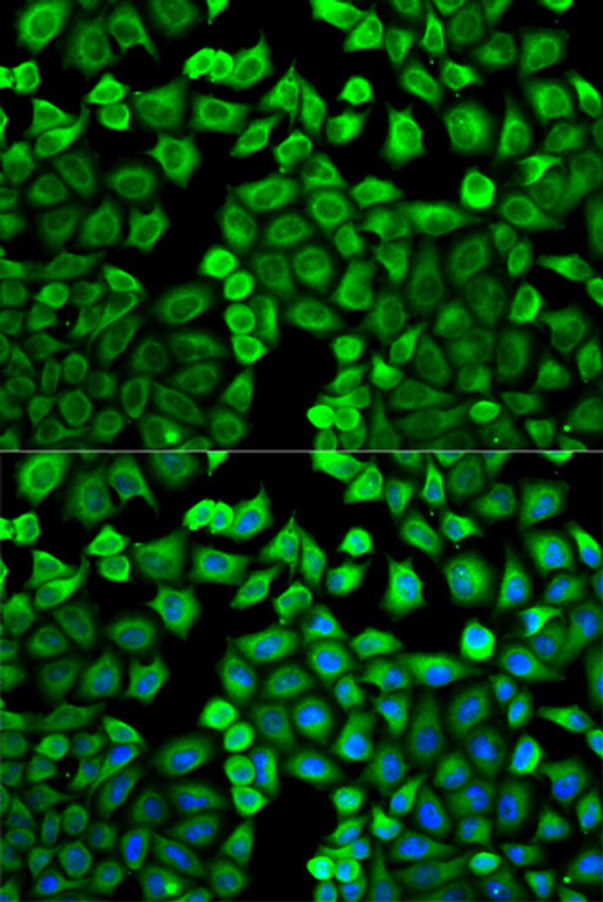 Immunofluorescence analysis of U2OS cells using HNMT antibody (18-684) . Blue: DAPI for nuclear staining.