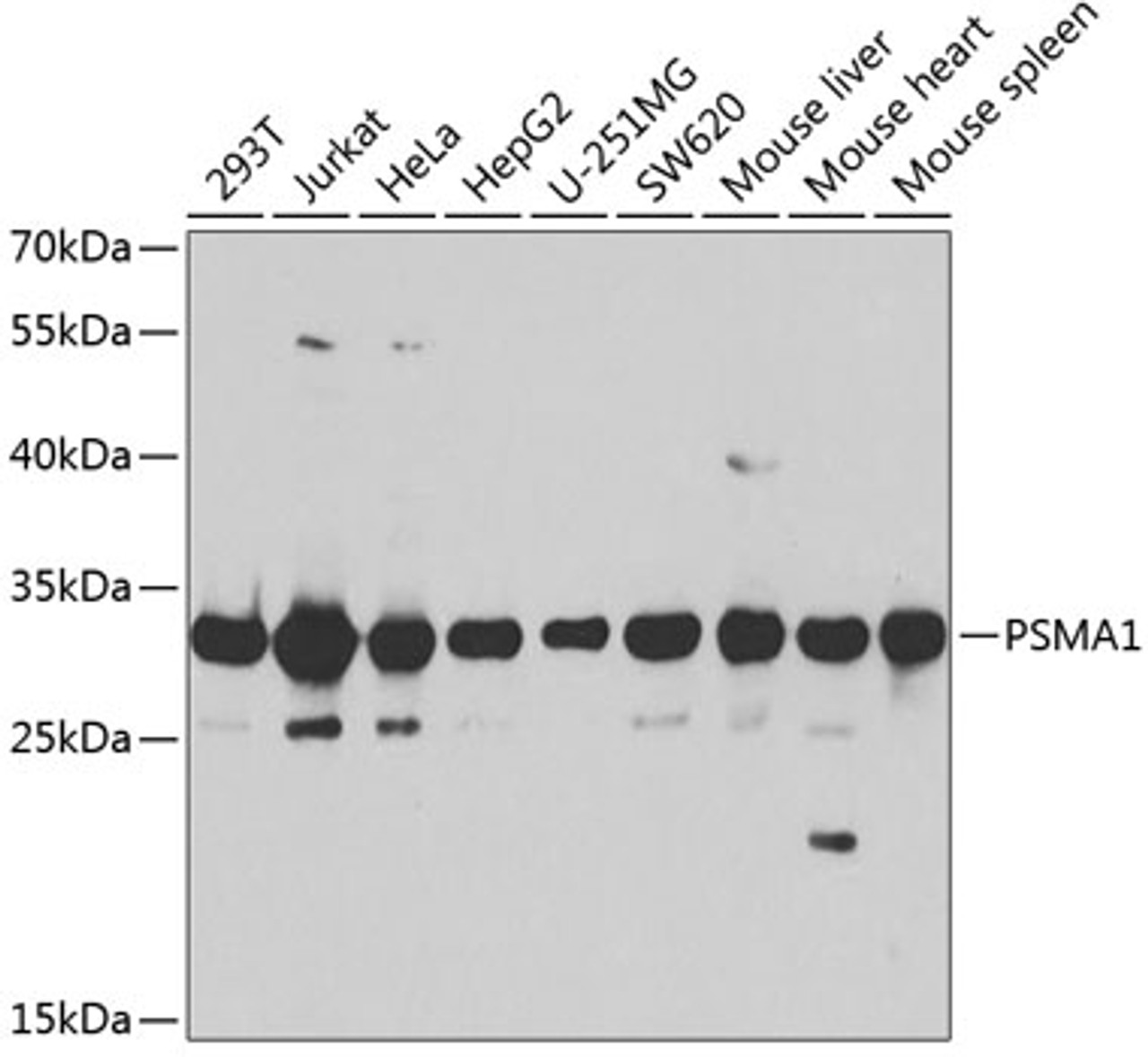 Western blot analysis of extracts of various cell lines, using PSMA1 antibody (18-687) at 1:1000 dilution.<br/>Secondary antibody: HRP Goat Anti-Rabbit IgG (H+L) at 1:10000 dilution.<br/>Lysates/proteins: 25ug per lane.<br/>Blocking buffer: 3% nonfat dry milk in TBST.