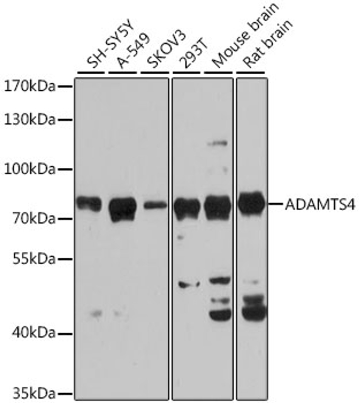 Western blot analysis of extracts of various cell lines, using ADAMTS4 antibody (18-689) at 1:3000 dilution.<br/>Secondary antibody: HRP Goat Anti-Rabbit IgG (H+L) at 1:10000 dilution.<br/>Lysates/proteins: 25ug per lane.<br/>Blocking buffer: 3% nonfat dry milk in TBST.<br/>Detection: ECL Basic Kit.<br/>Exposure time: 30s.