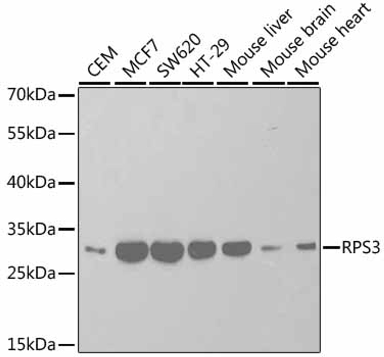 Western blot analysis of extracts of various cell lines, using RPS3 antibody (18-695) at 1:1000 dilution.<br/>Secondary antibody: HRP Goat Anti-Rabbit IgG (H+L) at 1:10000 dilution.<br/>Lysates/proteins: 25ug per lane.<br/>Blocking buffer: 3% nonfat dry milk in TBST.