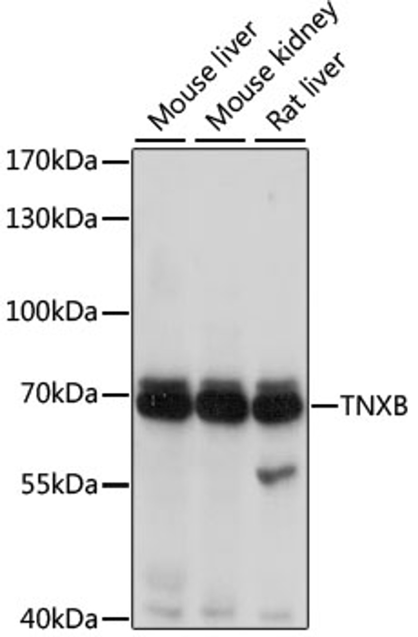 Western blot analysis of extracts of various cell lines, using TNXB antibody (18-697) at 1:1000 dilution.<br/>Secondary antibody: HRP Goat Anti-Rabbit IgG (H+L) at 1:10000 dilution.<br/>Lysates/proteins: 25ug per lane.<br/>Blocking buffer: 3% nonfat dry milk in TBST.<br/>Detection: ECL Basic Kit.<br/>Exposure time: 1s.