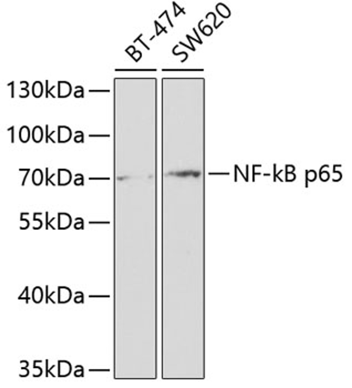 Western blot analysis of extracts of various cell lines, using NF-kB p65 antibody (18-701) at 1:1000 dilution.<br/>Secondary antibody: HRP Goat Anti-Rabbit IgG (H+L) at 1:10000 dilution.<br/>Lysates/proteins: 25ug per lane.<br/>Blocking buffer: 3% nonfat dry milk in TBST.