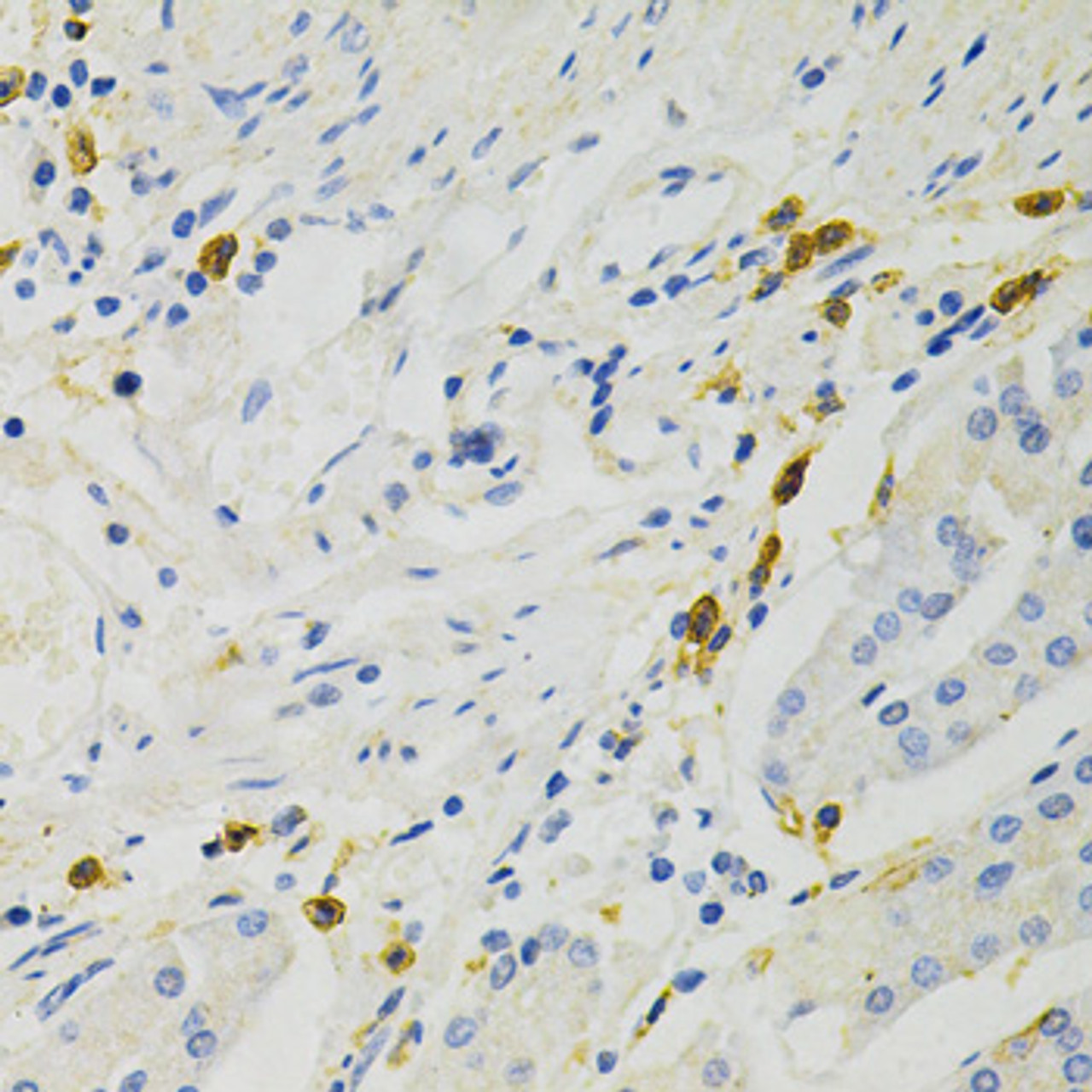 Immunohistochemistry of paraffin-embedded rat lung using NF-kB p65 Antibody (18-701) at dilution of 1:100 (40x lens) .